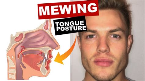 mewing tongue position